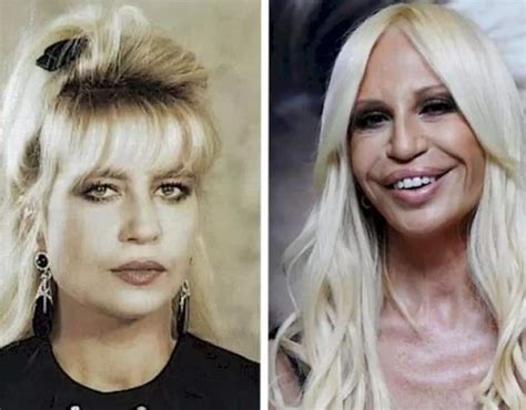 versace mare donna|what happened to donatella versace's face.